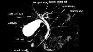 MRCP planning and protocol [upl. by Htieh]