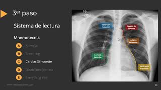 Tutorial Radiografía de Torax [upl. by Ha]