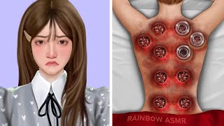 ASMR Cupping Therapy amp Worm Infected Removal [upl. by Rika]