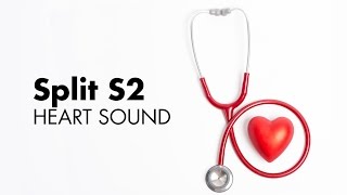 Fixed Split S2  Heart Sounds  MEDZCOOL [upl. by Omura]