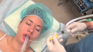 Dr Malamed local anesthesia maxillary injections [upl. by Lisk957]