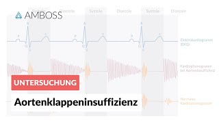 Aortenklappeninsuffizienz  Herzgeräusch  AMBOSS Video [upl. by Lepper788]