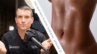 32 Everything You Need To Know About Liposuction [upl. by Kostival572]