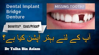 Denture Dental Bridge or Dental Implant for missing tooth and its costprice By Dr Talha Bin Aslam [upl. by Atnohsal911]