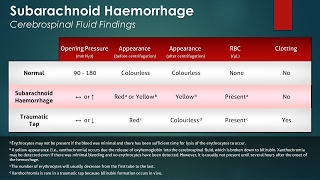 Subarachnoid Hemorrhage SAH Cerebrospinal Fluid Findings [upl. by Assilam]