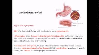 Diagnosed with H Pylori  My H Pylori Symptoms [upl. by Farrington]