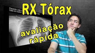 Raio X Tórax  Avaliação rápida [upl. by Olotrab]