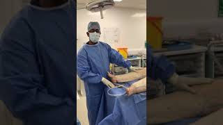 Lower Limb Lipoedema Liposuction  Part Three  Stage 3 Lipoedema [upl. by Uaeb717]