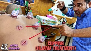 Hijama Treatment For Dead Cells  Cupping Technique By Asim  Neck Cracking  ASMR 4K [upl. by Sessler]