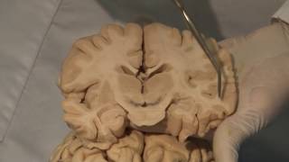 Cortical Localization Neuroanatomy Video Lab  Brain Dissections [upl. by Duthie]