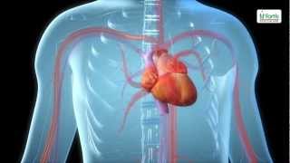 Angioplasty Procedure Animation Video [upl. by Nylrehc]