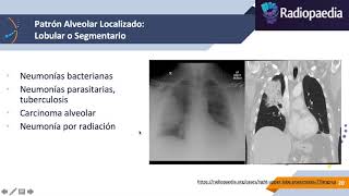 Imagenología de Tórax Patologías [upl. by Hintze]