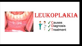 Leukoplakia  Causes Diagnosis amp Treatment [upl. by Ameerahs]