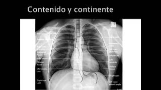 evaluacion de radiografia de torax [upl. by Laux]