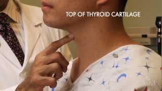 Radioactive Iodine Therapy to Treat Thyroid Cancer [upl. by Meehyr392]