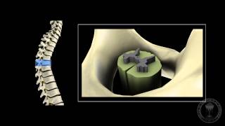 Neuroanatomy  The spinal cord [upl. by Malloy]