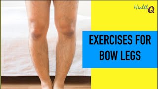 Easy Exercises for bow legs [upl. by Boudreaux]