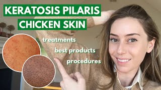 Keratosis Pilaris How to treat dry bumpy skin aka chicken skin  Dr Shereene Idriss [upl. by Naivaf301]