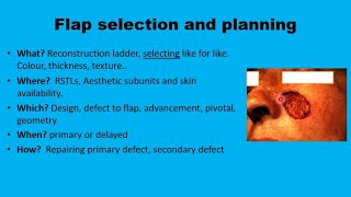 11 Facial flaps The Basics [upl. by Tace]